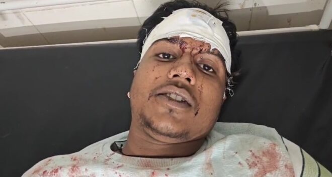 कैमोर थाना क्षेत्र से आई हैरान करने वाली घटना ने इलाके में सनसनी फैला दी है।